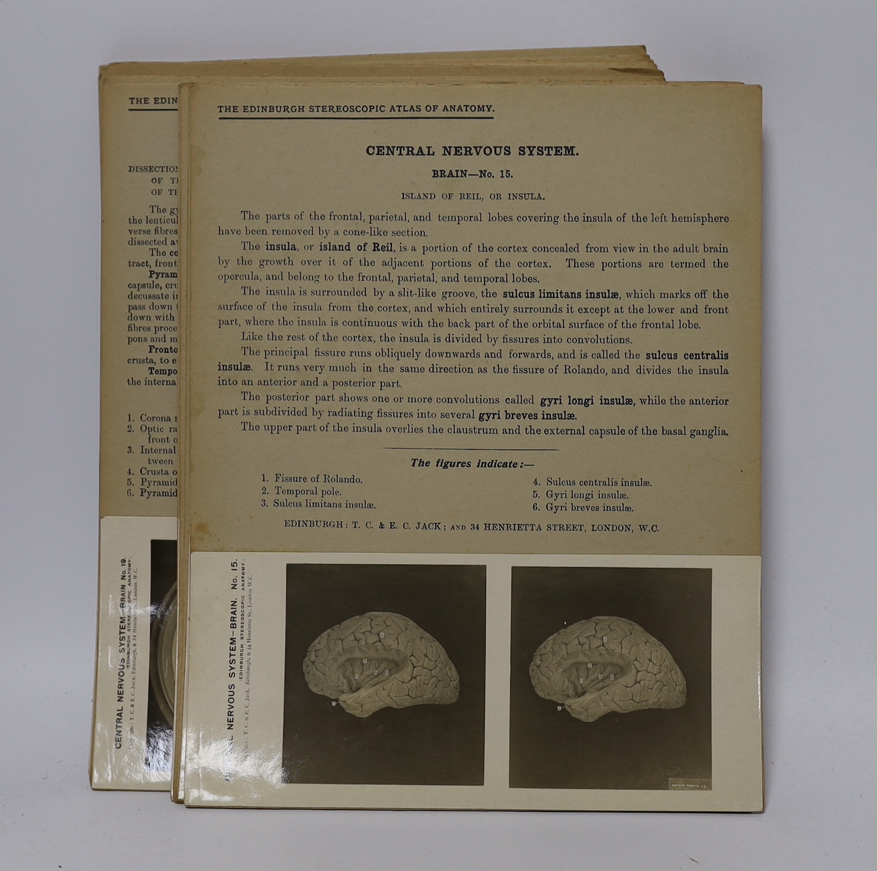 Stereoscopic cards from a set by The Edinburgh Stereoscopic Atlas of Anatomy with detailed information above the photographs, together with a small number of additional cards of different subjects